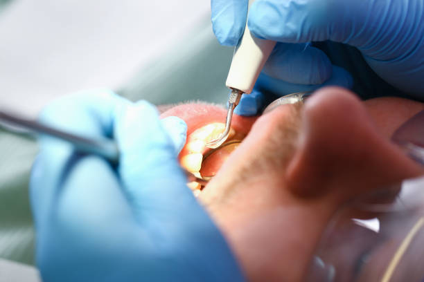 Best Holiday Emergency Dentist in Marion, IL