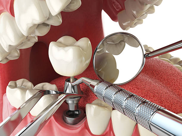 Best Emergency Dental Services for Seniors in Marion, IL